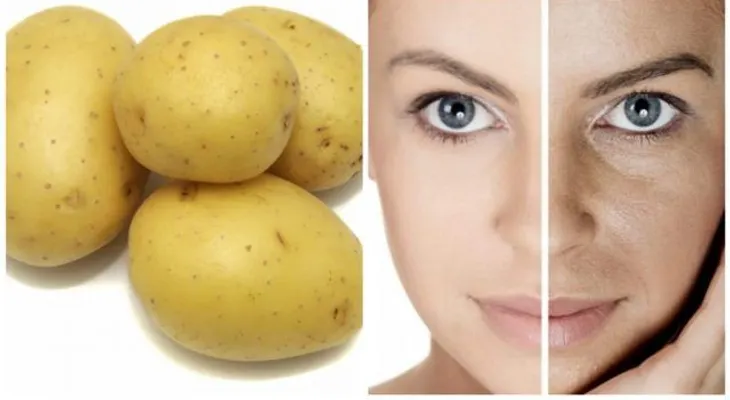 Las manchas: eliminala en 3 noches con este simple remedio