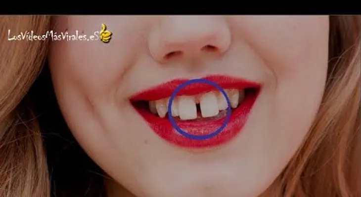 Conoce la sorprendente razón cuando una mujer tiene los dientes separados (VIDEO)