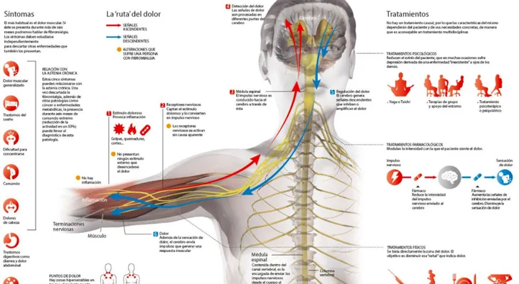 Fibromialgia, cuando el dolor es real