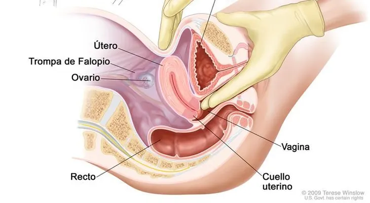 Tratamiento tumores de ovario de bajo potencial maligno