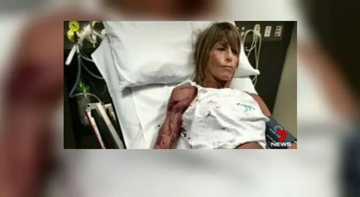 Australiana es atacada brutalmente por un canguro