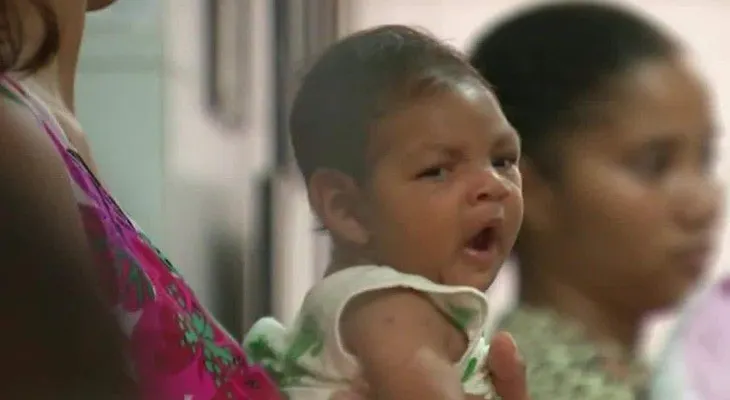 CDC: Virus del Zika definitivamente causa defectos de nacimiento