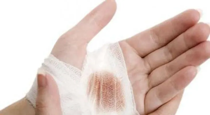 12 datos curiosos sobre las heridas