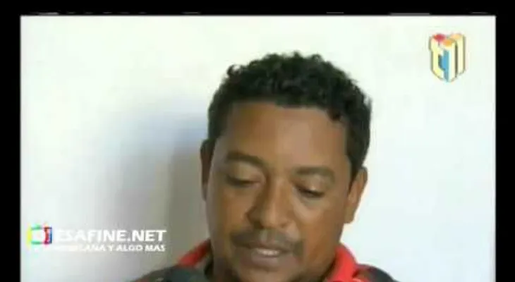 Mira cómo quedó este dominicano cuando su celular explotó  (VIDEO)