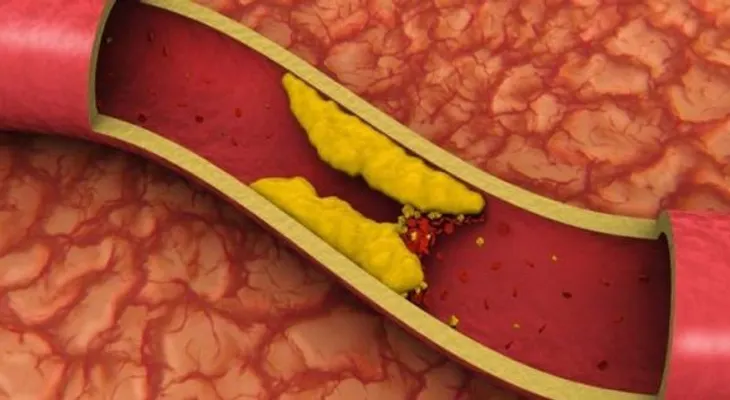 4 cucharadas de esto y adiós a la presión arterial y arterias obstruidas