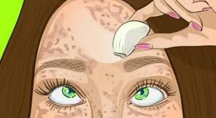 El remedio para la piel perfecta que borra las manchas como una goma (en hombres y mujeres)