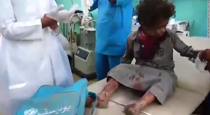 Decenas de niños que iban en un autobús escolar mueren por un bombardeo en Yemen