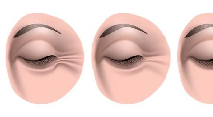 Crema de 3 ingredientes para reducir las arrugas de los ojos
