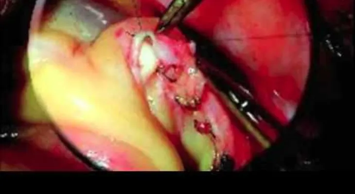 Un médico explica gravísimas enfermedades de la carne de cerdo o puerco (VIDEO)