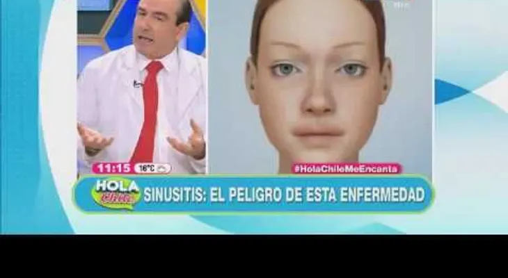 Sinusitis: El peligro de esta enfermedad