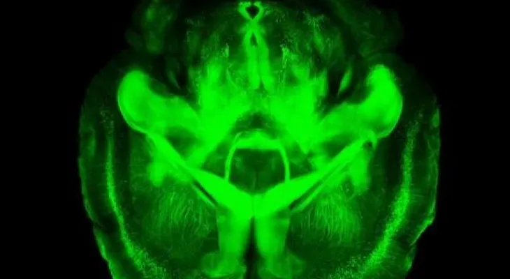 Ensayan una terapia con el virus de la polio contra el cáncer cerebral