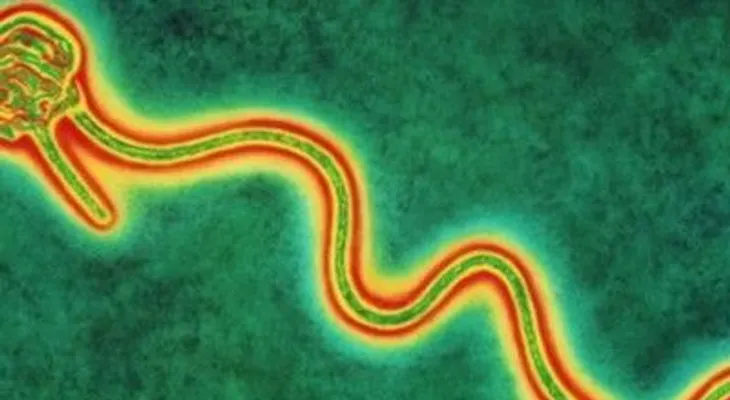 6 formas en las el ébola sí se contagia