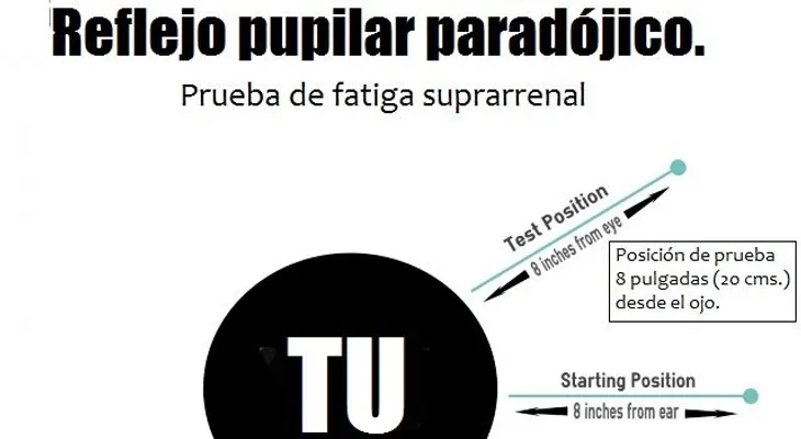  La causa real de la fatiga adrenal no es lo que piensas 