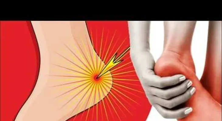 Si te duele el talón al despertar o sin estar parado mucho tiempo, esto le está pasando a tu cuerpo