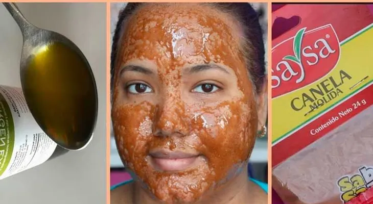 Tres gotas de aceite de canela y dos cucharadas de aceite de oliva y tu rostro quedará como nuevo 