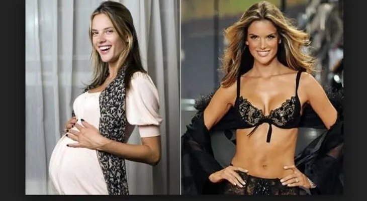 "Mommy Makeover": técnica para recuperar la figura tras dar a luz