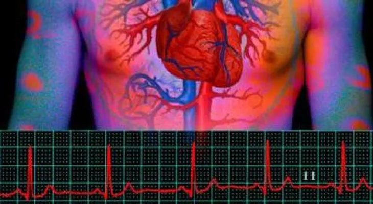 Pacientes de ataque cardiaco tratados de noche o en el fin de semana tienen peores resultados