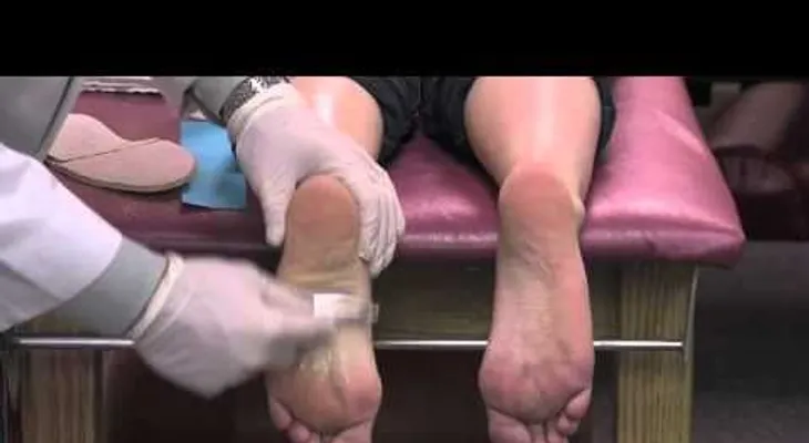 Esta mujer sufría de un terrible dolor en los talones de los pies, pero sucedió algo increíble (VIDEO)