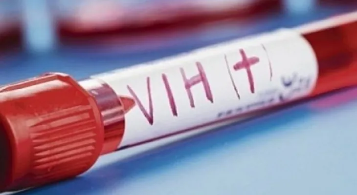 Empezarán pronto a probar vacuna contra el VIH