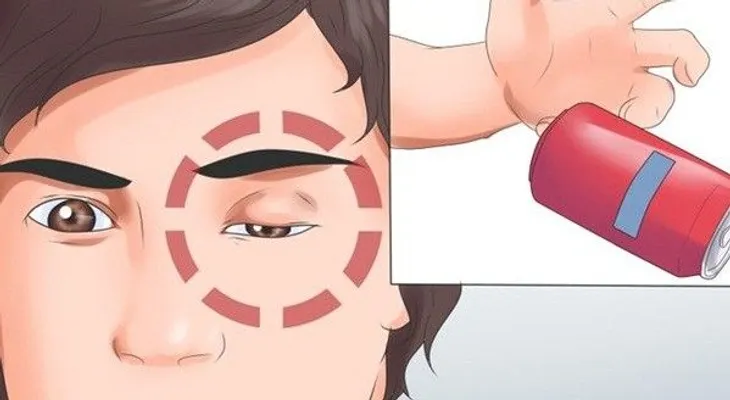 Conoce los síntomas de un derrame cerebral antes de que suceda