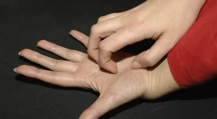 Eczema, una enfermedad inflamatoria, no infecciosa