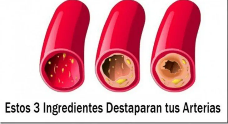 3 ingredientes que destapan las arterias y protegen al corazón