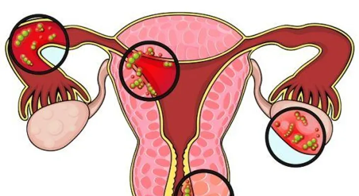 Vagina hinchada causas y tratamientos naturales