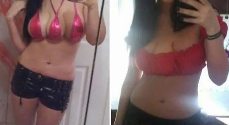 Mujer se somete a cirugía para tener tres senos