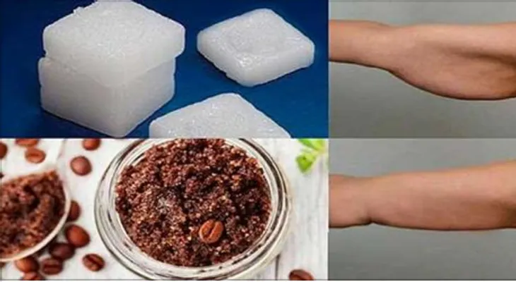 Los cirujanos están mudos después que se descubrió que el alcanfor con café elimina la flacidez...
