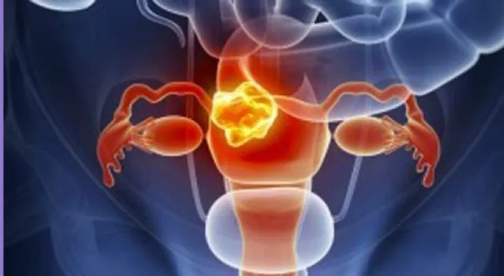 Los beneficios de la soya para el cáncer de cuello uterino son cuestionables