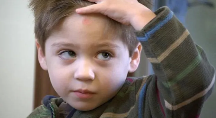 Cómo los golpes en la cabeza pueden afectar a la vida de un niño