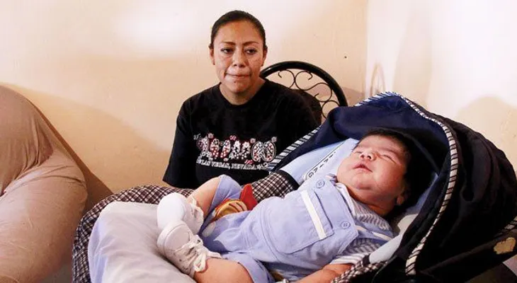 Nace "bebé gigante" en Colombia