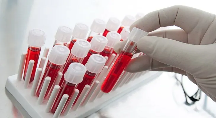 Potencial prueba de sangre para detectar cualquier tipo de cáncer