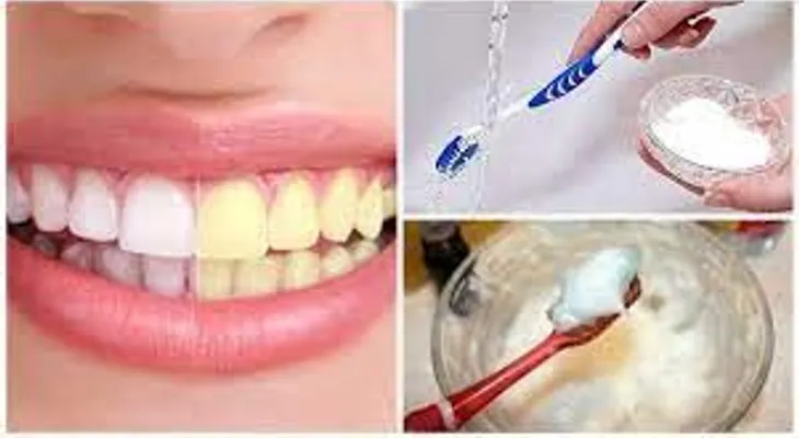 Imperdible receta para eliminar el sarro y blanquear tus dientes