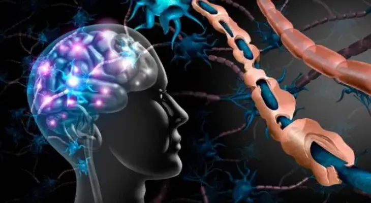 Innovaciones médicas son una esperanza para pacientes con esclerosis múltiple
