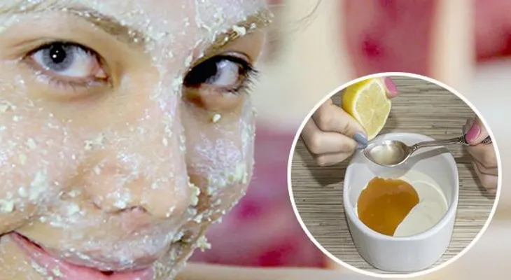 Ella logró blanquear su piel y eliminar las manchas oscuras de su cara, con solo 3 ingredientes! 