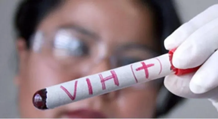  Una mayor cantidad de casos VIH en menores de 30 años, por poco uso de preservativos