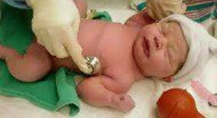 Brasil investiga posible relación entre casos de microcefalia y virus zika