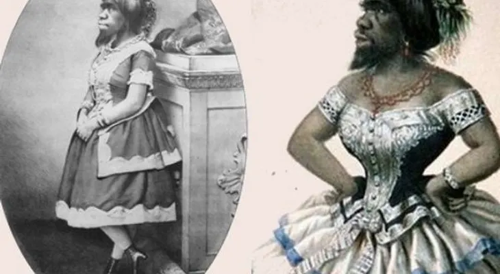 Julia Pastrana: El destino se ensañó con ella hasta después de su muerte (VIDEO)