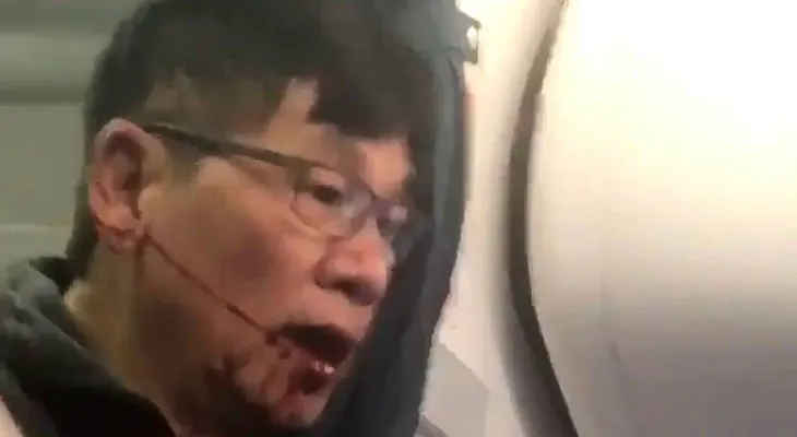 El polémico pasado del doctor David Dao desalojado del vuelo de United Airlines