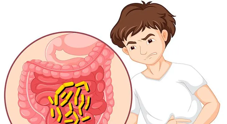 6 alimentos que debes evitar si padeces colitis