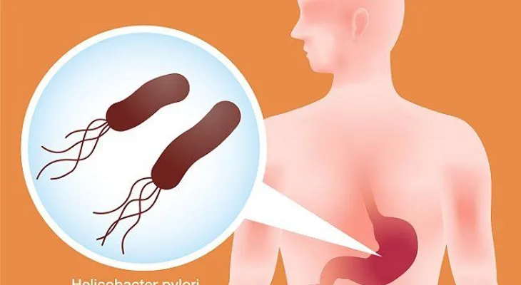 Elimina la bacteria Helicobacter Pylori con los consejos de este médico japonés