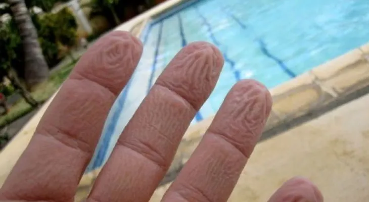¡Así que ESA es la razón del por qué se arrugan los dedos en el agua!