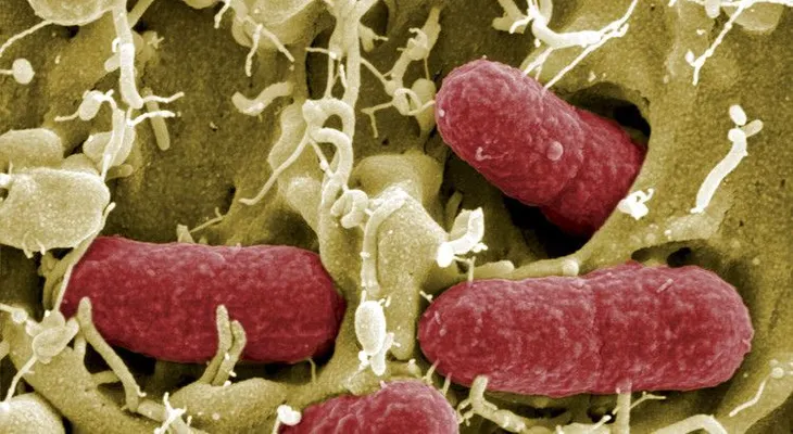 Descubren un supermicrobio resistente a antibióticos muy potentes