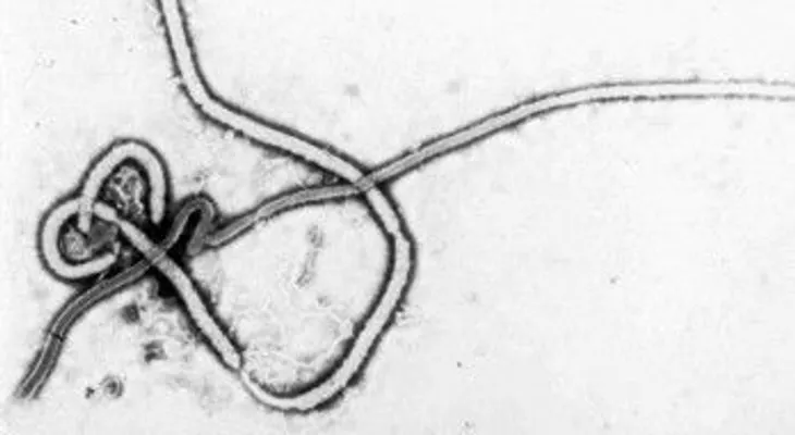 Sobrevivientes de ébola pueden transmitir enfermedad vía sexual