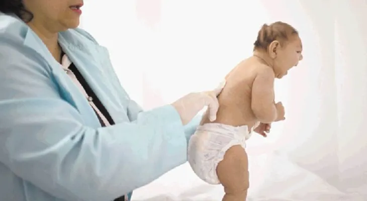 Informe sobre el nacimiento de niño con anomalías congénitas, incluso microcefalia.