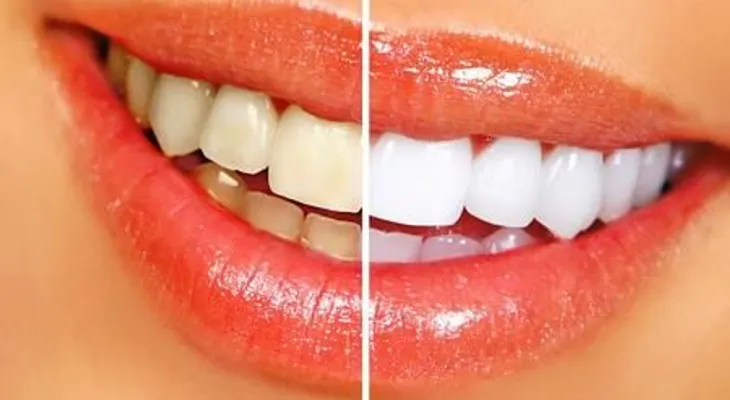 10 trucos caseros para lograr unos dientes perfectos