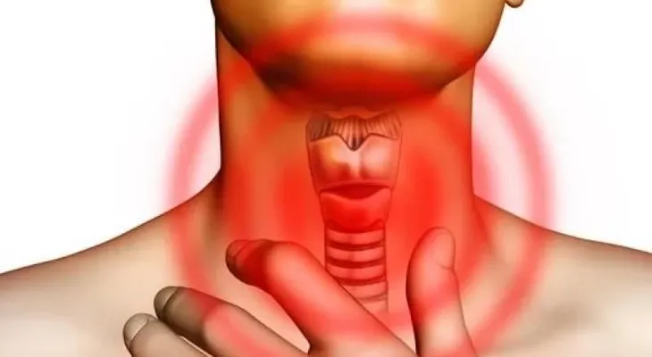 Esta es la única receta que cura infección de garganta en 4 horas; remedio para la tos, gripe y limpiar tus pulmones