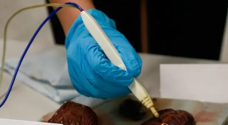 Científicos crean máquina capaz de "oler" el cáncer