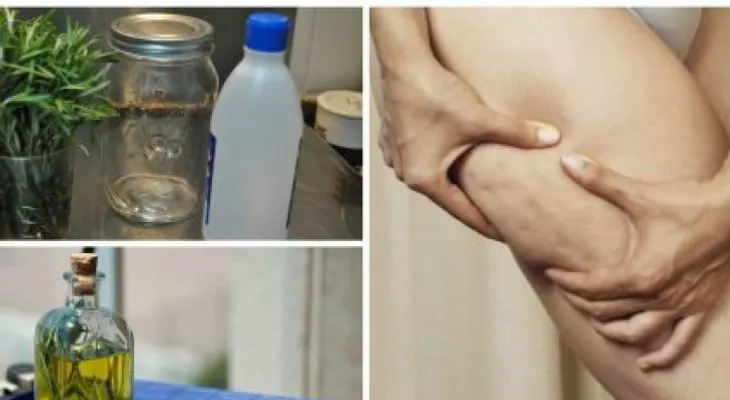 Alcohol de romero casero para combatir la celulitis